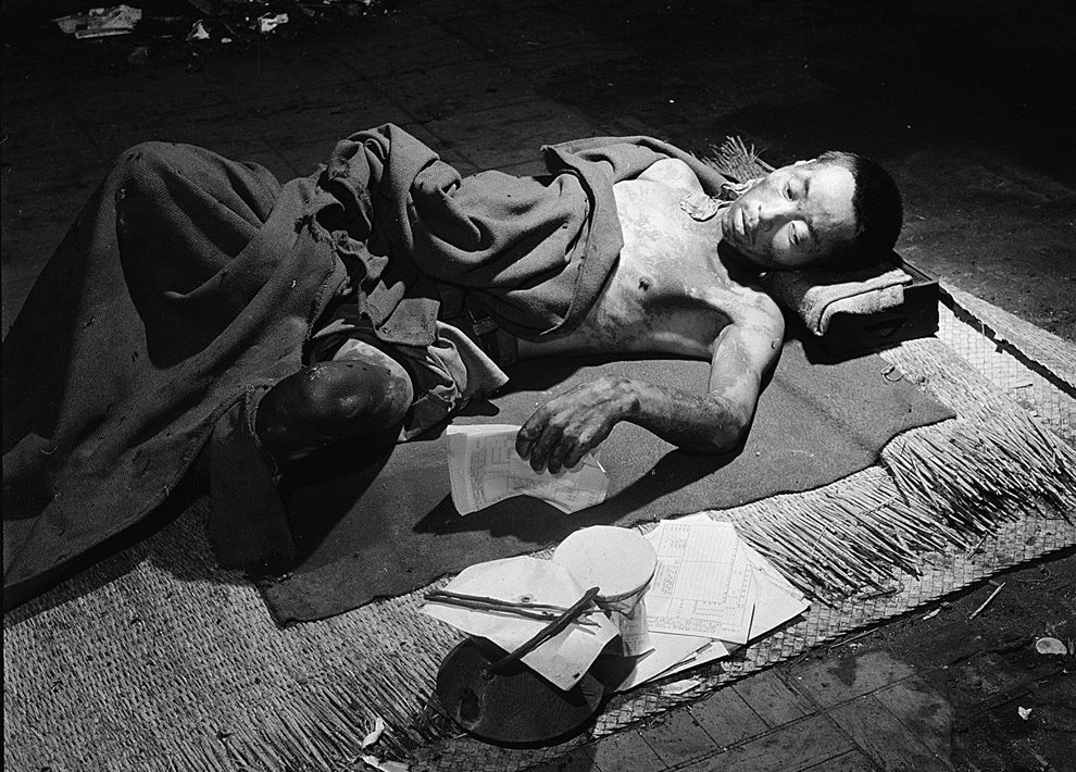 A victim of the bombing in Hiroshima lies in a makeshift hospital located in 