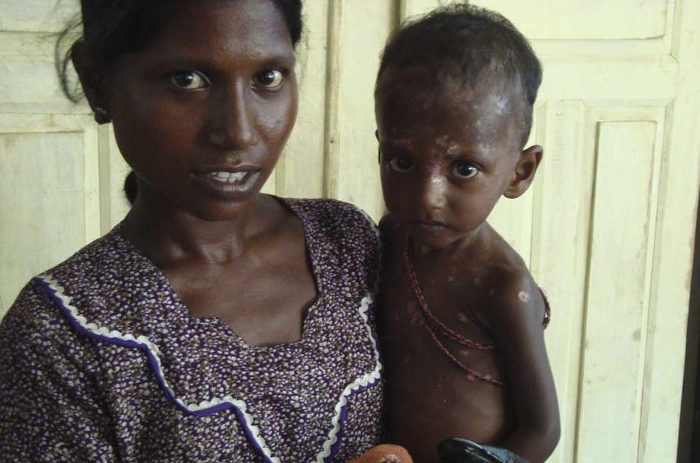 Фотография: Беженцы на Шри-Ланке №22 - BigPicture.ru